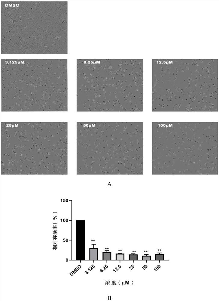 Medicine for treating or preventing human cervical cancer as well as preparation method and application thereof