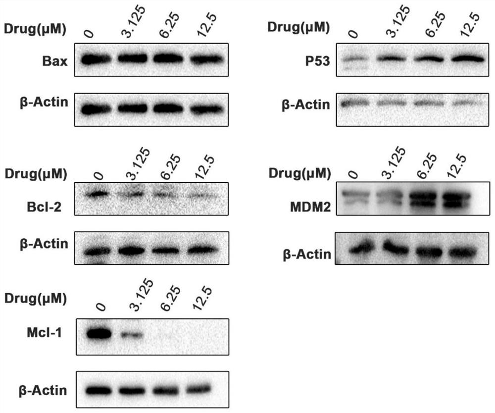 Medicine for treating or preventing human cervical cancer as well as preparation method and application thereof