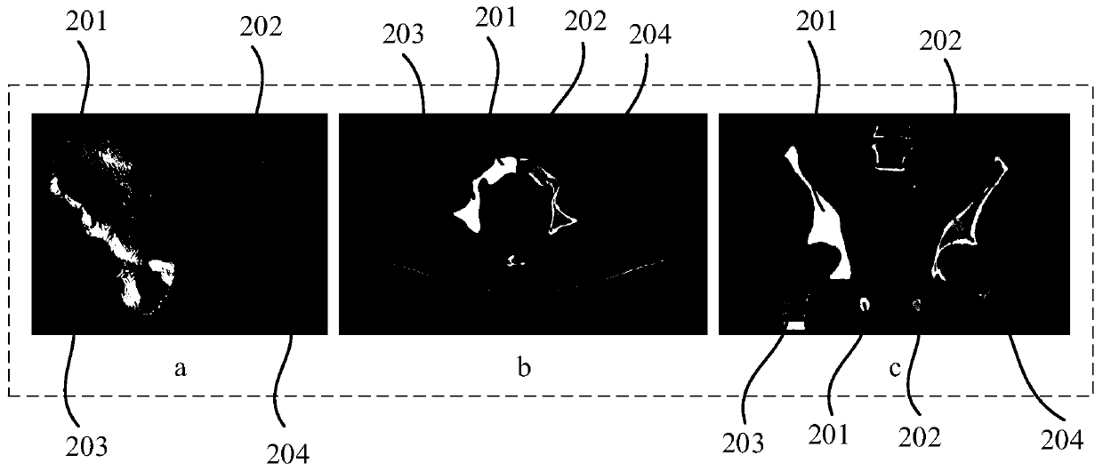 Hip joint segmentation method and device, electronic equipment and storage medium