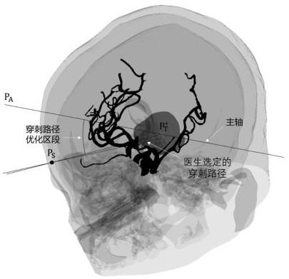 Computer-assisted puncture path planning method and device for craniocerebral puncture surgery and storage medium