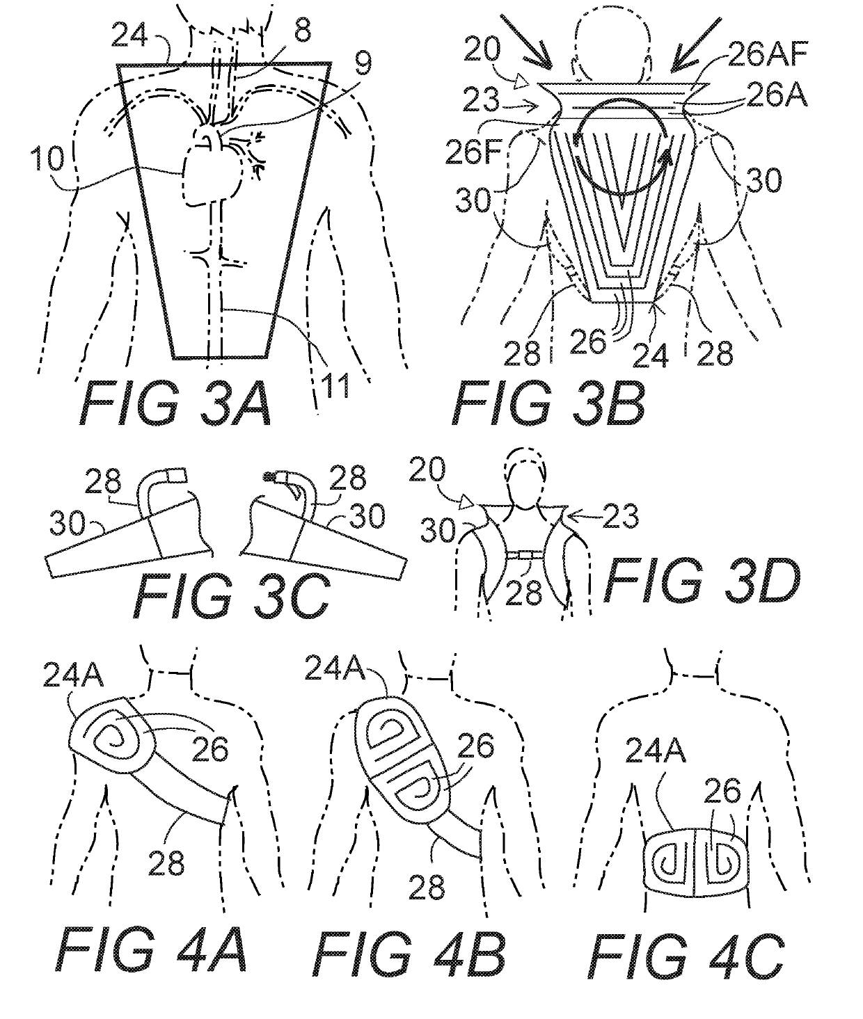 Body cool down device and method