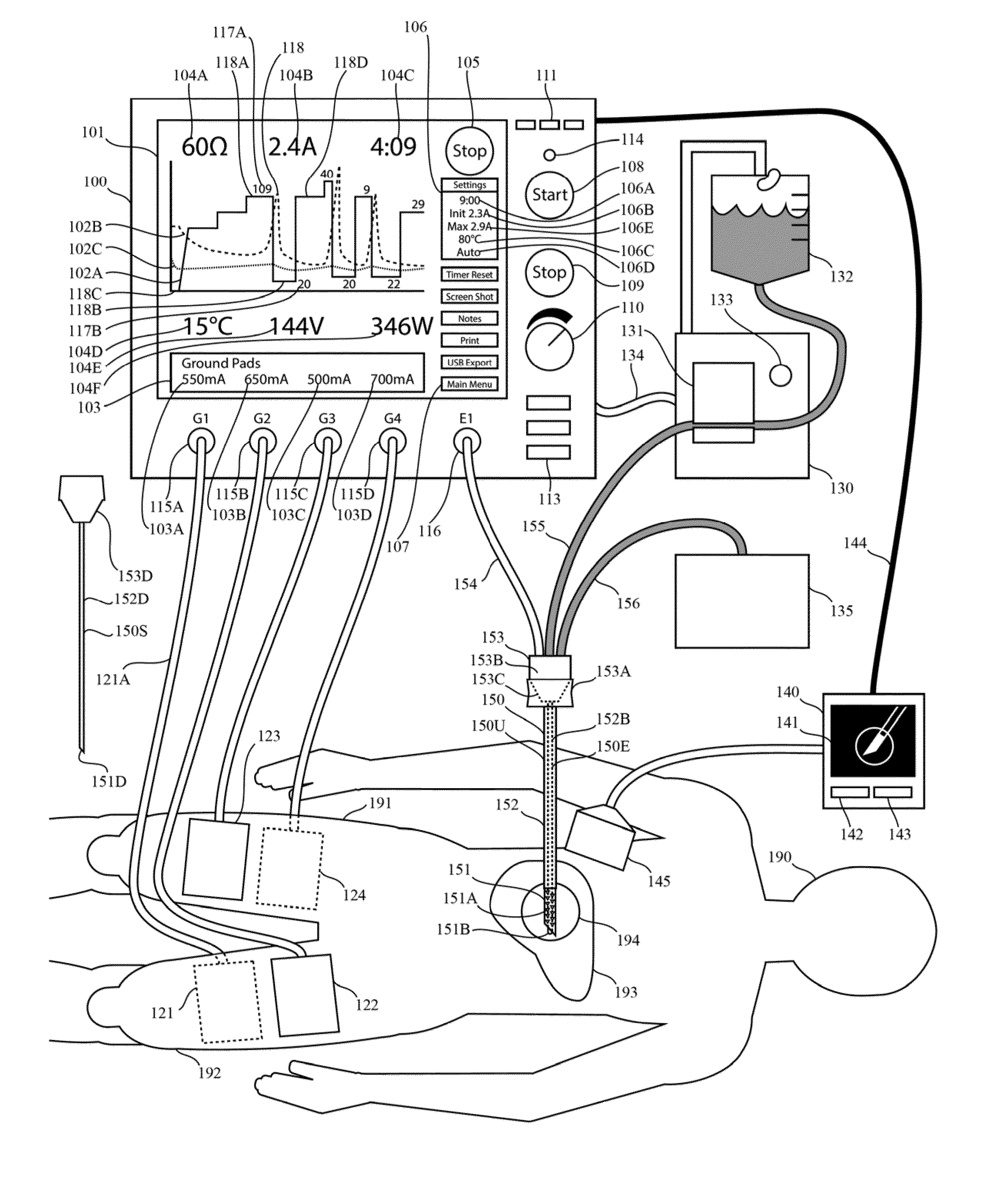 Electrosurgical generator