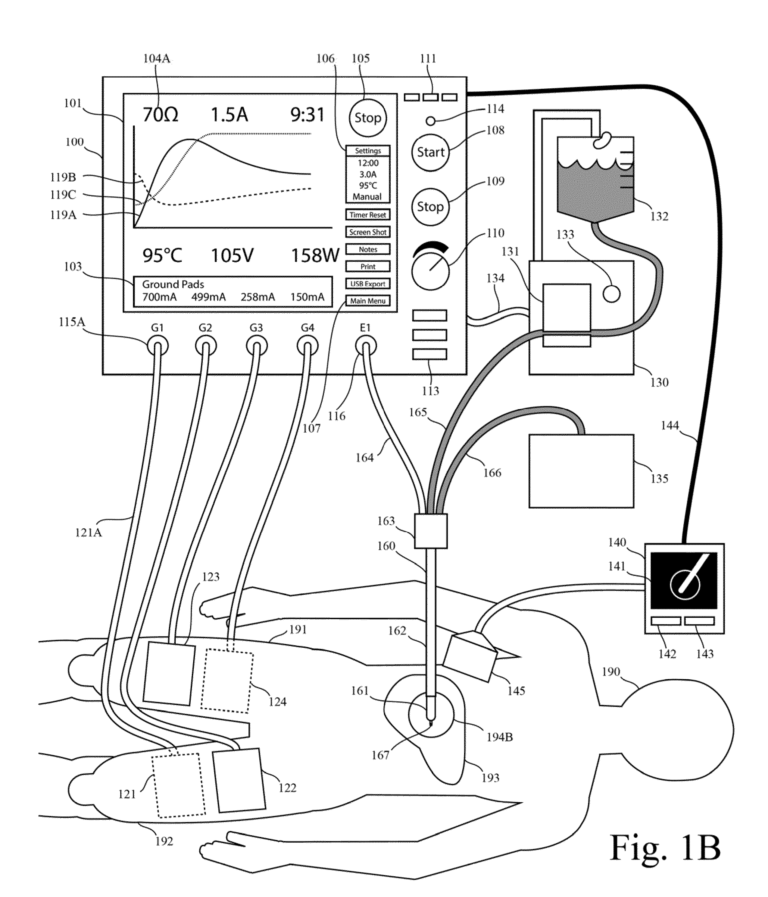 Electrosurgical generator