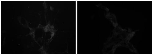 A method of inducing sh-sy5y cells to differentiate into dopaminergic neurons