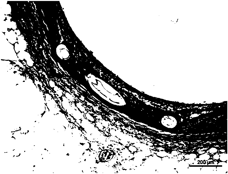 Absorbable iron-based instrument