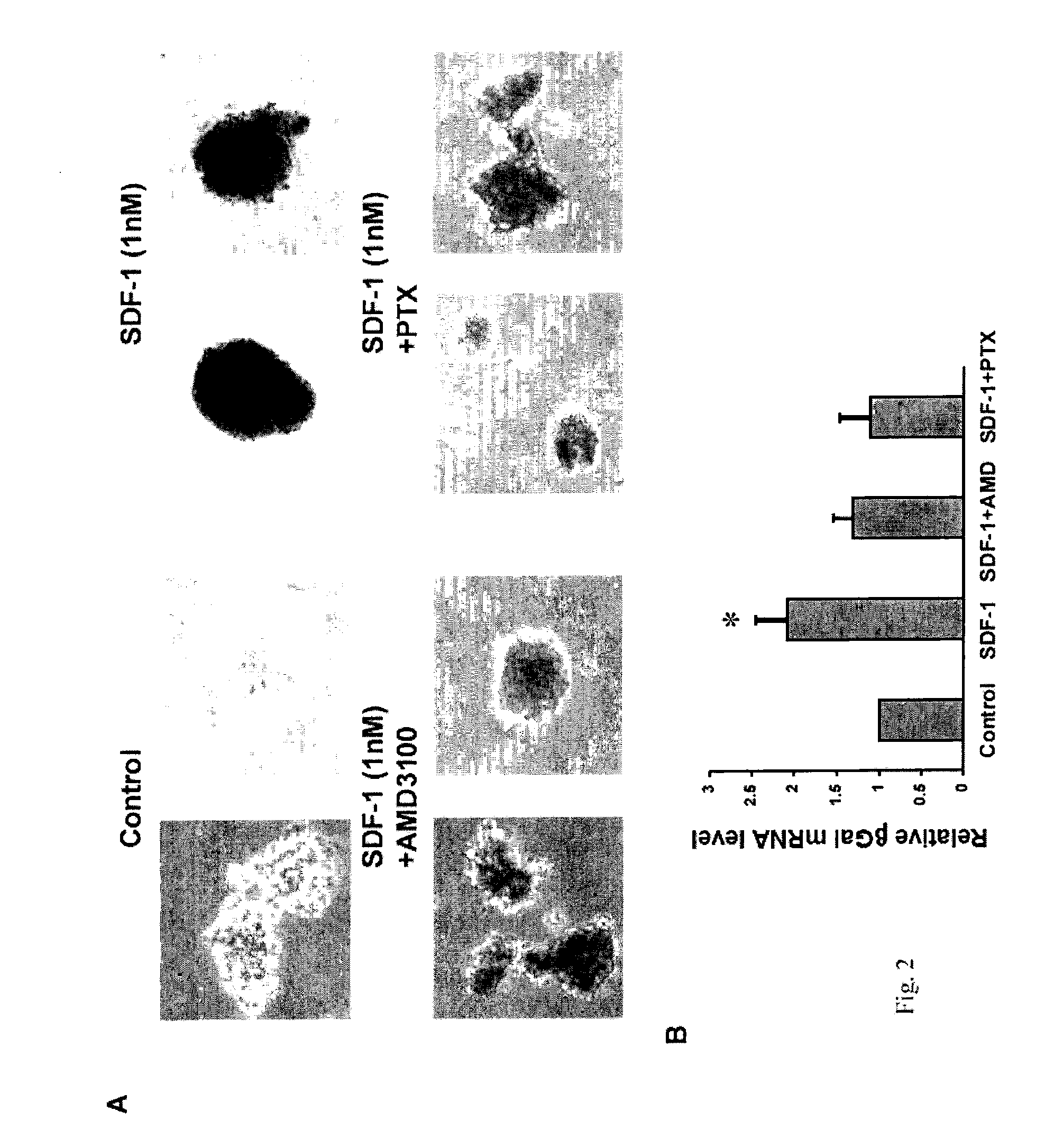 Therapeutic method for increasing pancreatic beta cell mass