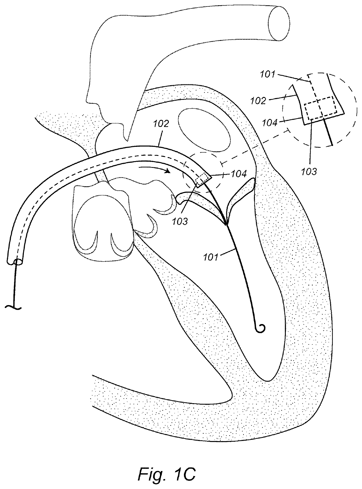 Devices, systems, and methods to optimize annular orientation of transcatheter valves