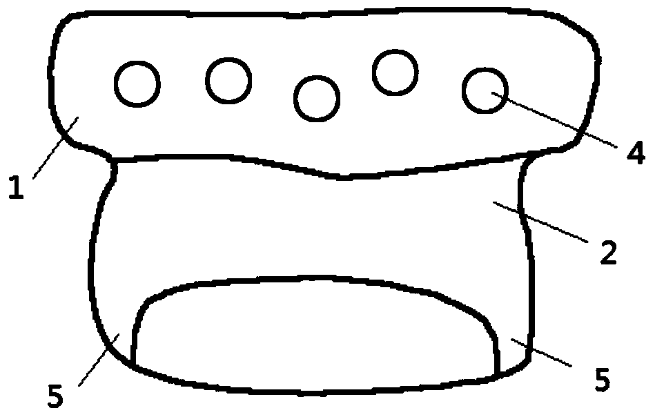 A personalized temporomandibular joint socket prosthesis