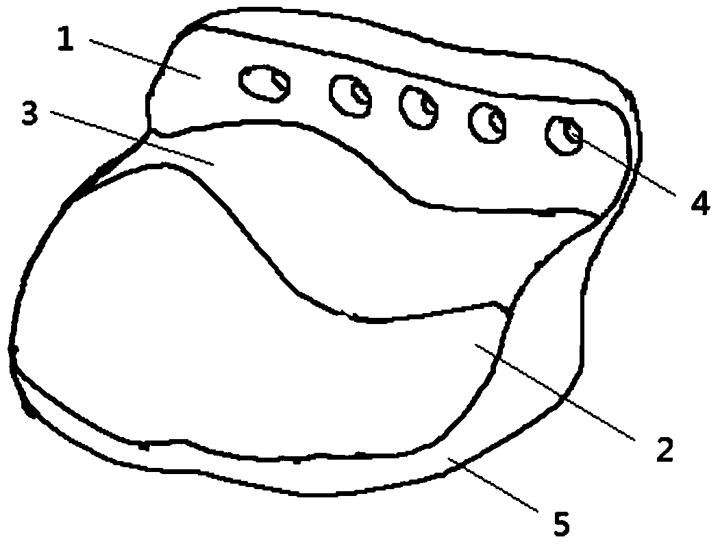 A personalized temporomandibular joint socket prosthesis