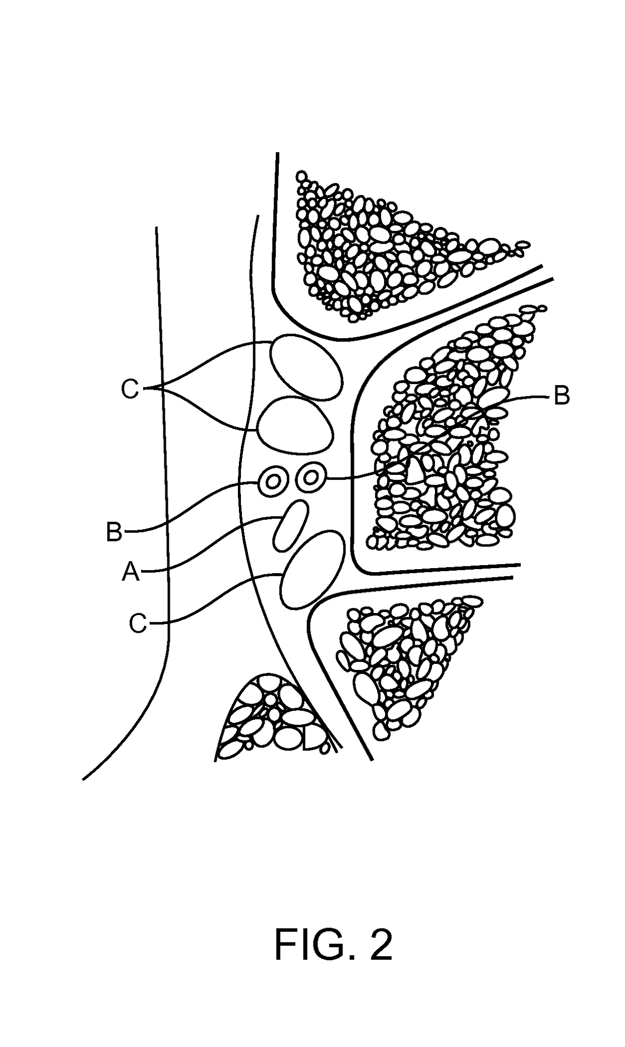 Methods and compositions for treating foot or hand pain