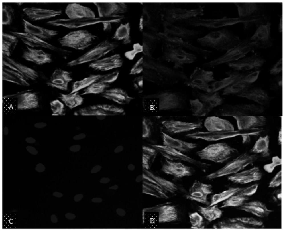 Application of sglt2 inhibitor in the preparation of reagents for inhibiting glucose absorption by pmcs or peritoneal fibrosis