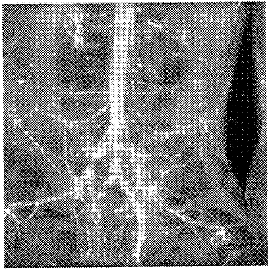 Superparamagnetic contrast media coated with starch and polyalkylene oxides