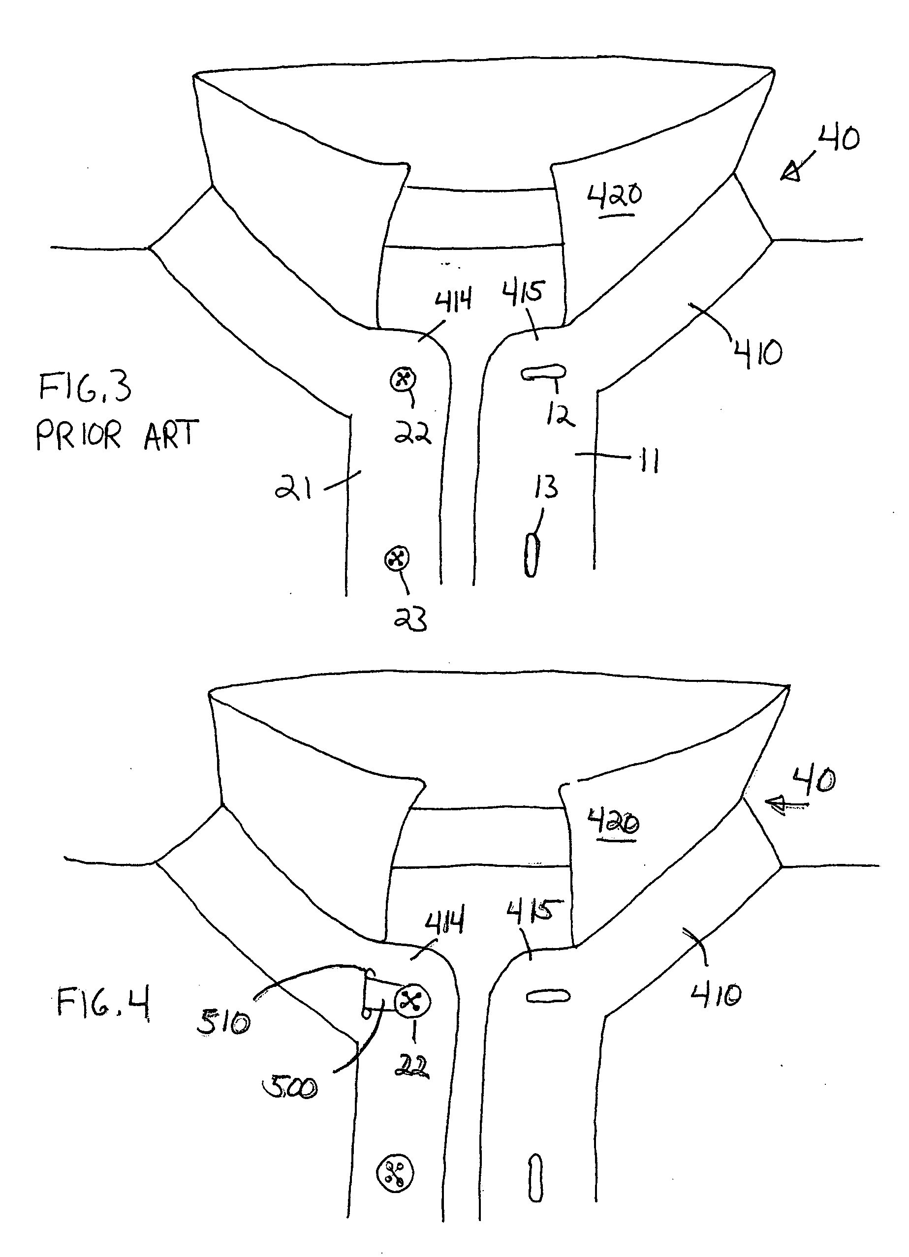 Expandable garment closure