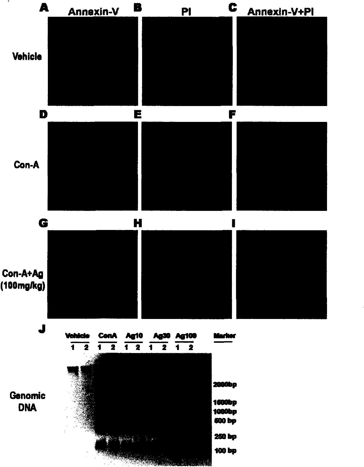 Application of andrographolidume to preparing medicine for treating acute liver injury