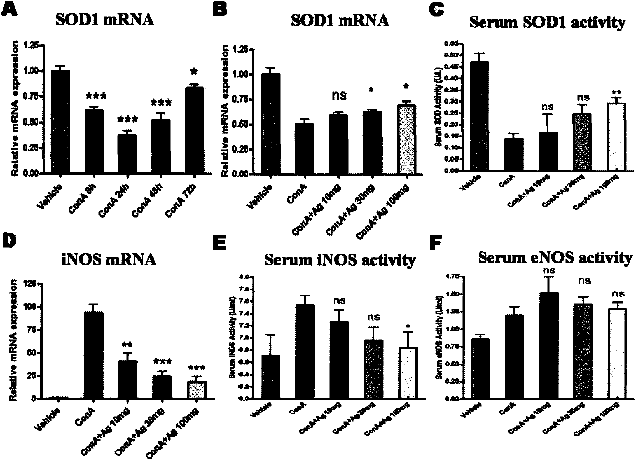 Application of andrographolidume to preparing medicine for treating acute liver injury