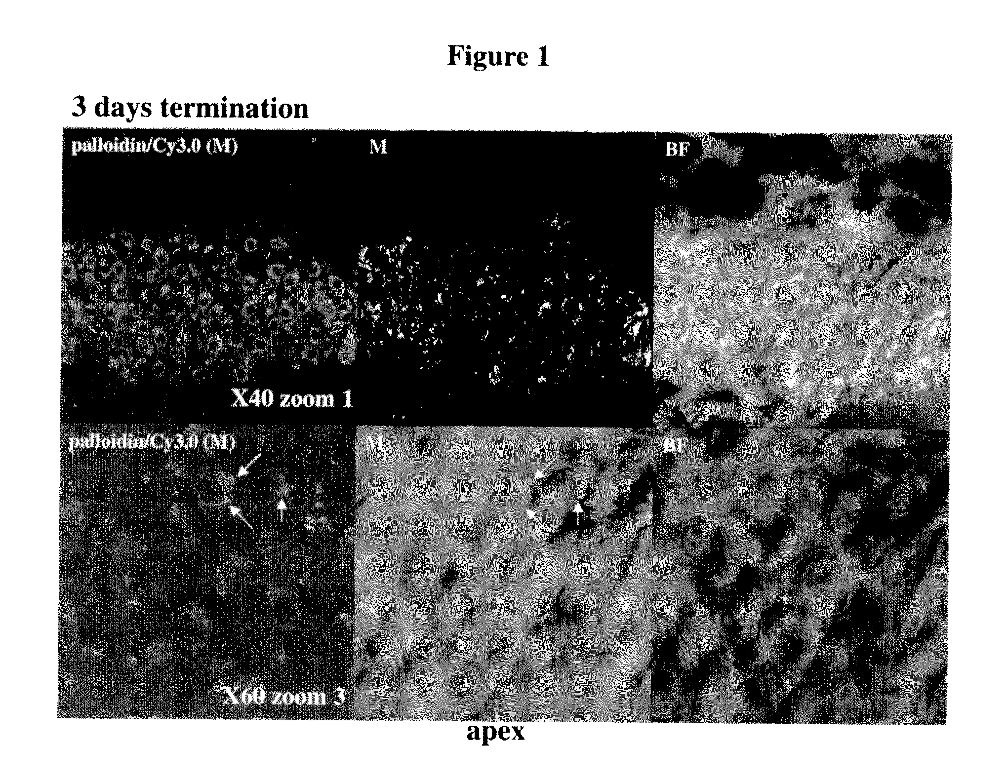 Compositions and methods for treatment of ear disorders