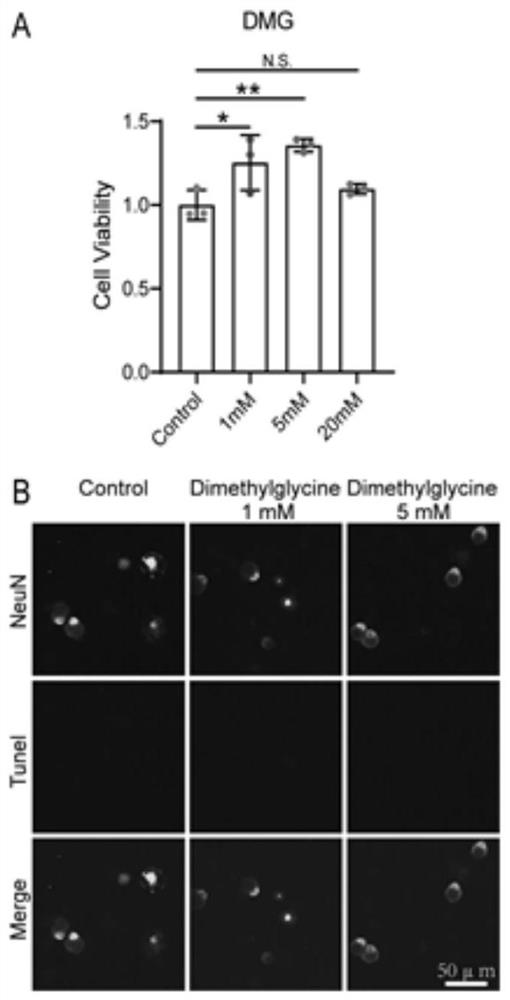 Application of N, N-dimethylglycine DMG to treating or repairing peripheral nerve injury