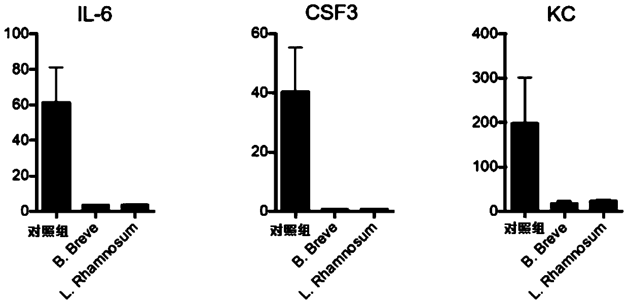 Application of microorganism in treatment and/or prevention of immune-mediated intestinal diseases