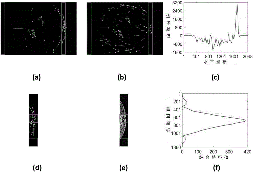 Optic disc segmentation method with combination of fundus image edge information and brightness information