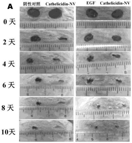 Skin Repair Peptide Cathelicidin-nv and Its Gene and Application