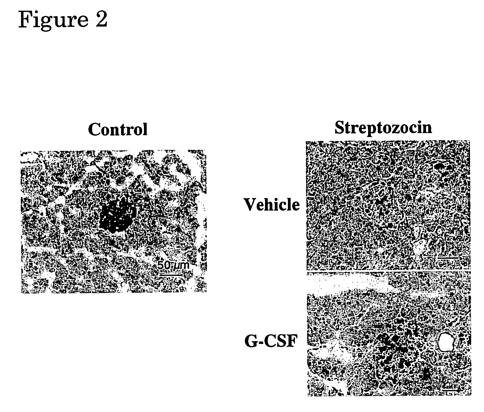 Method of preventing .beta. cell disruption in pancreatic Langerhans' islets