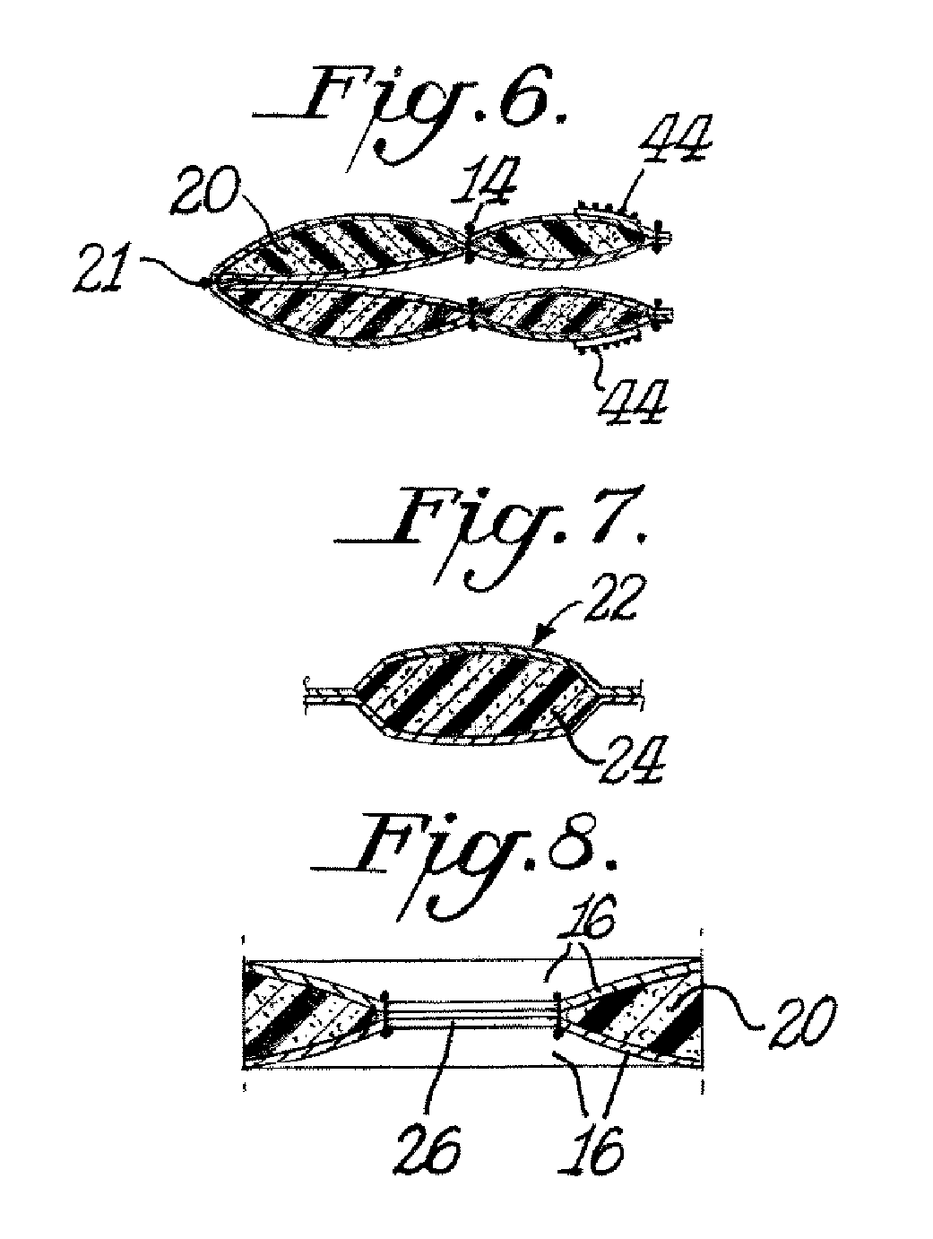 Anti-gravity decompressant for lower extremities