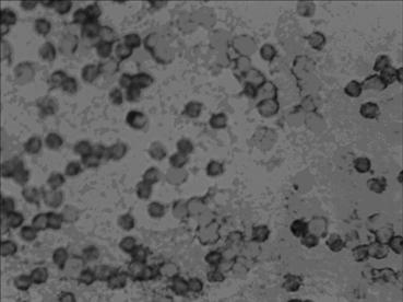 In-situ hybridization detection kit for MICRORNA (MICRO Ribonucleic Acid)-145 level at pathologic evolution early stages of various colon cancers as well as microRNA-145 in-situ hybridization detection method and application of microRNA-145 to preparation of in-situ hybridization detection kit for colon cancers