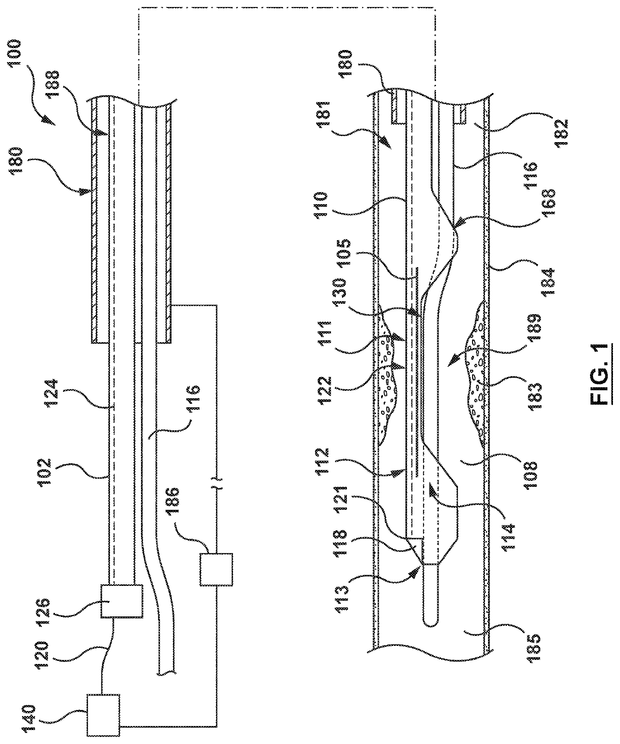 Catheter and method for calculating fractional flow reserve