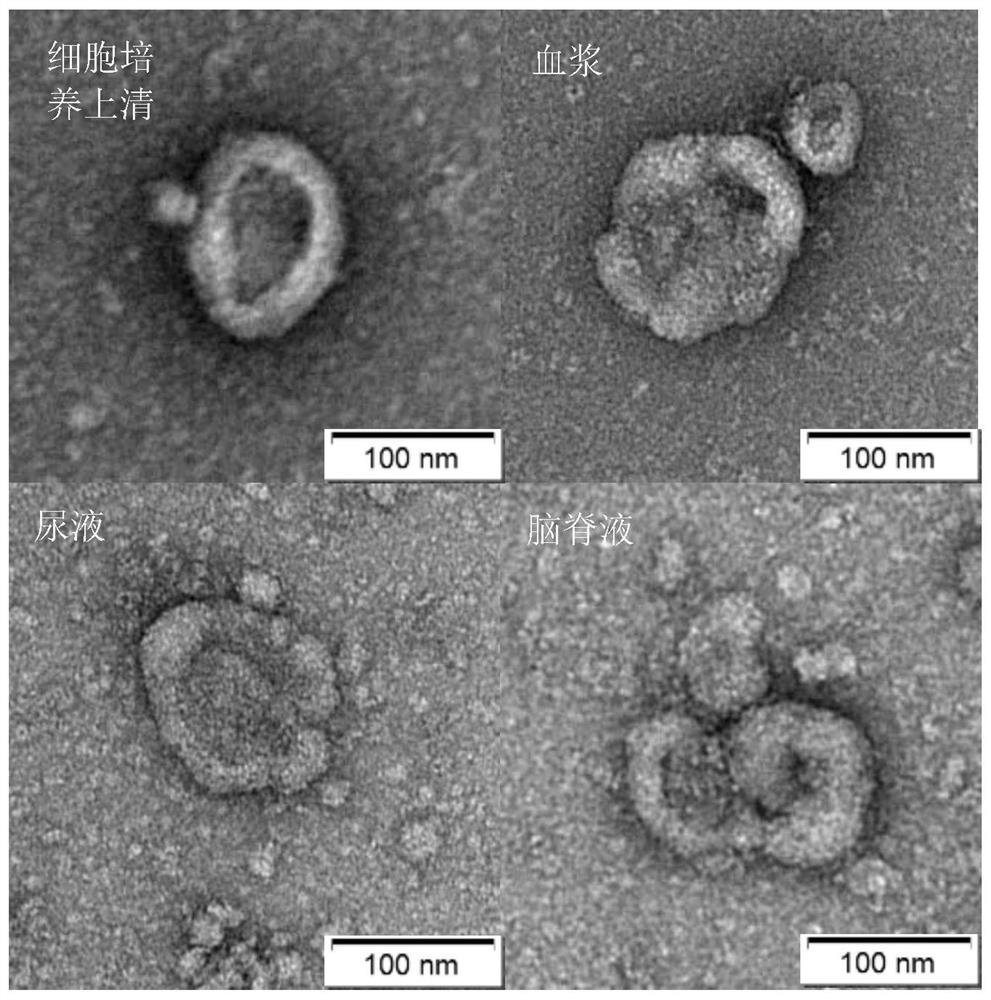 Application of lectin-magnetic carrier coupling compound in separation of glycosylated exosome