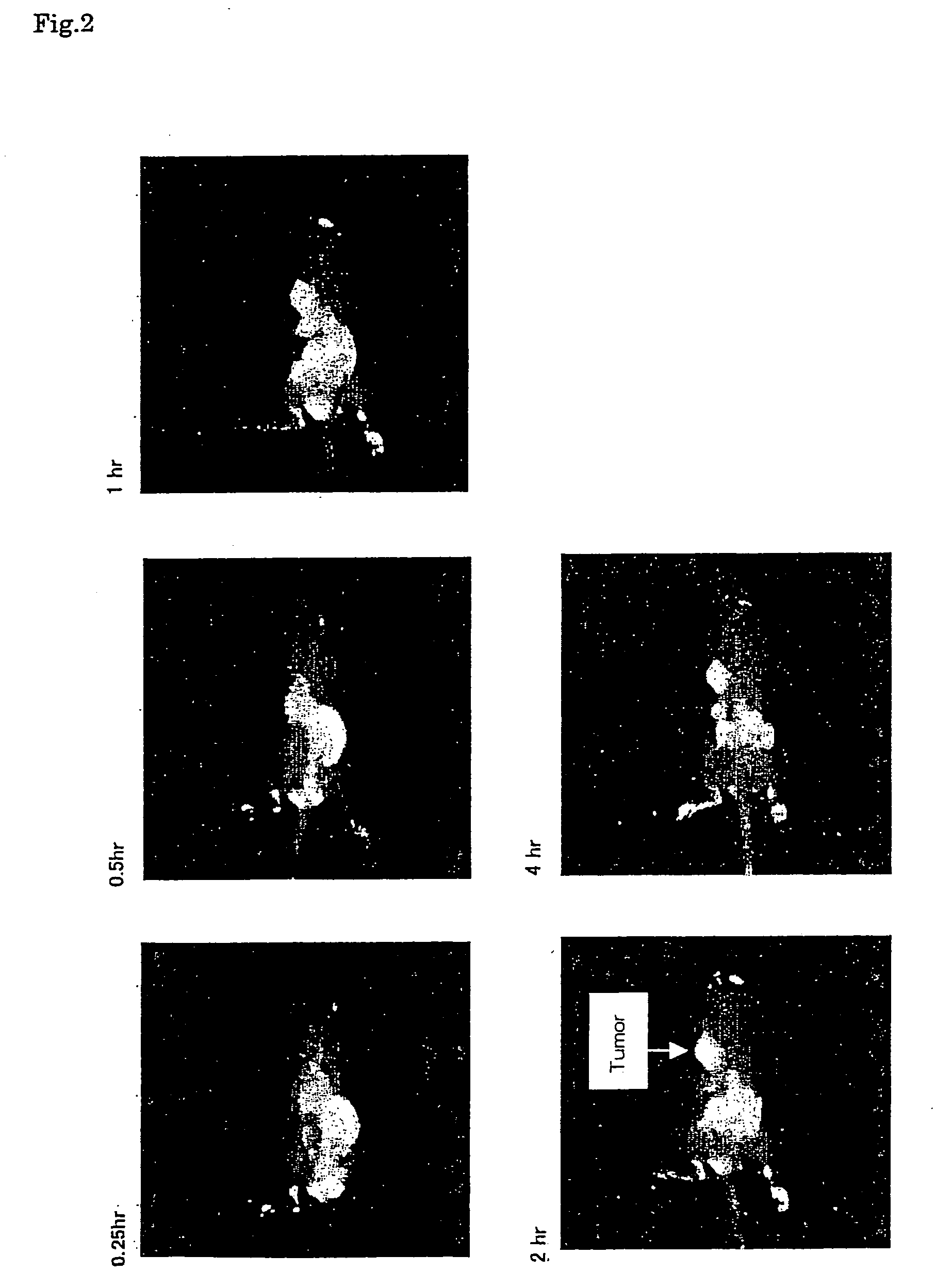 Near infrared fluorescent contrast agent and method for fluorescence imaging