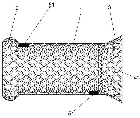 Biodegradable cardia support