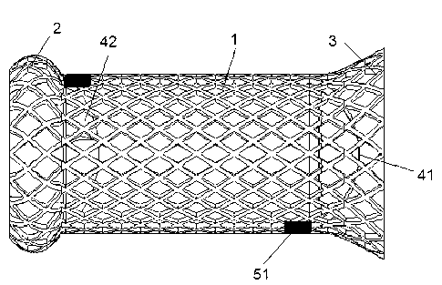 Biodegradable cardia support