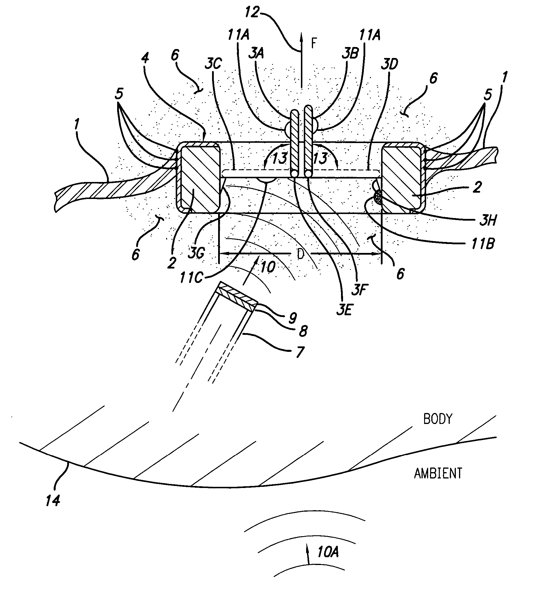 Non-contact damage-free ultrasonic cleaning of implanted or natural structures having moving parts and located in a living body