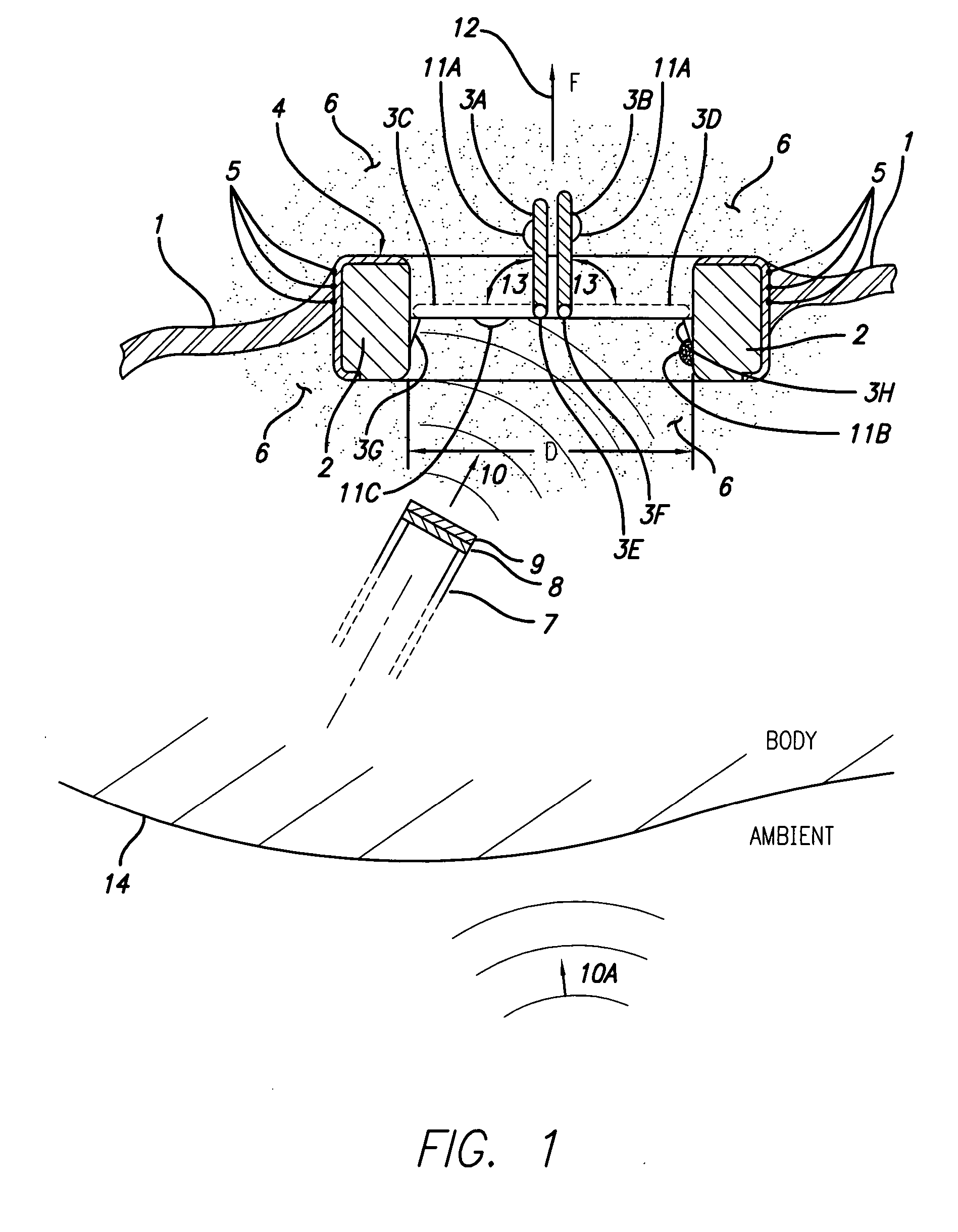 Non-contact damage-free ultrasonic cleaning of implanted or natural structures having moving parts and located in a living body