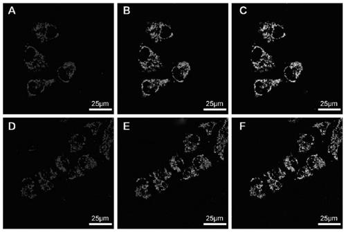 Near-infrared fluorescent compound with AIE performance and its preparation method and application