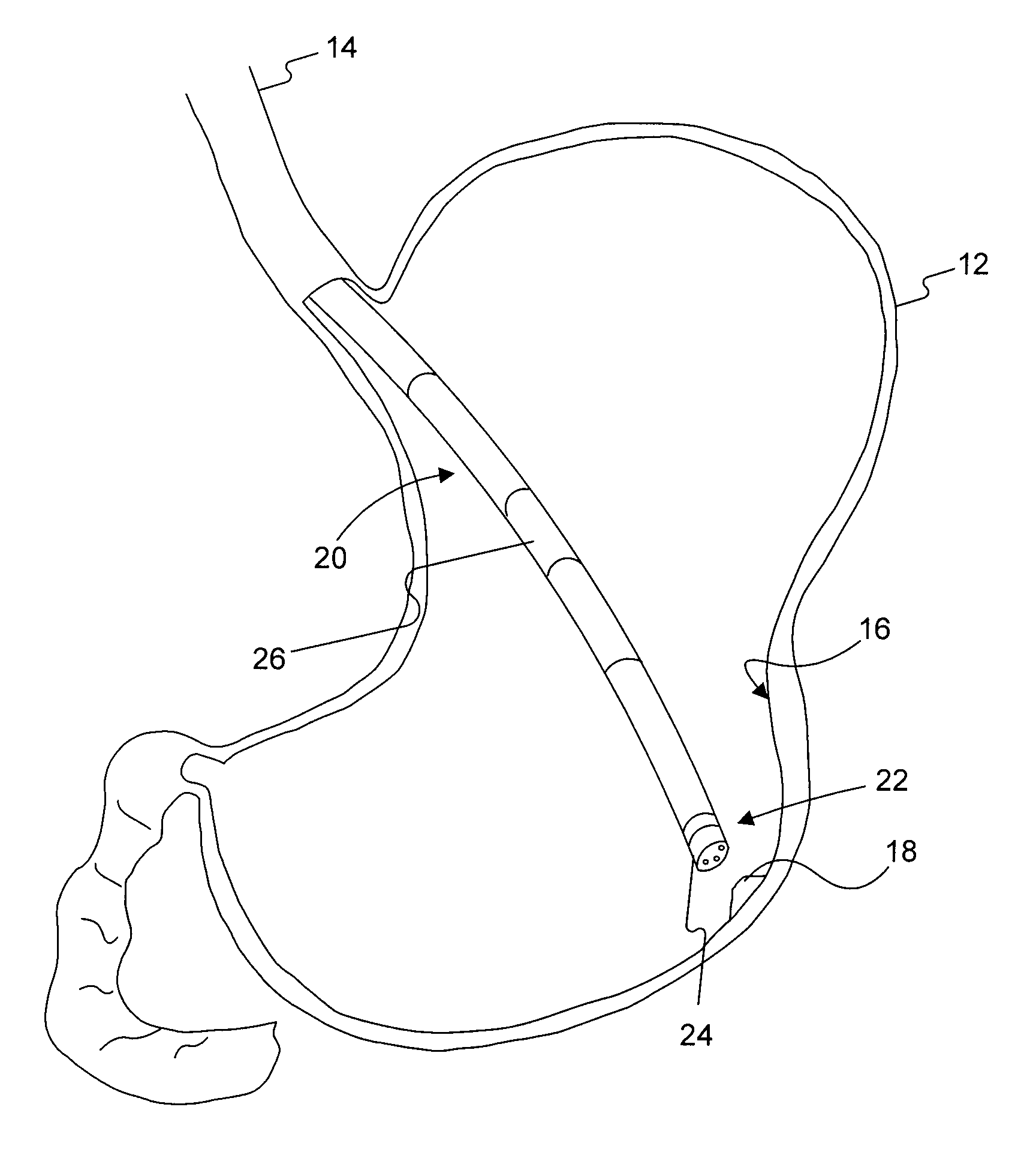 Ultrasound endoscopic system