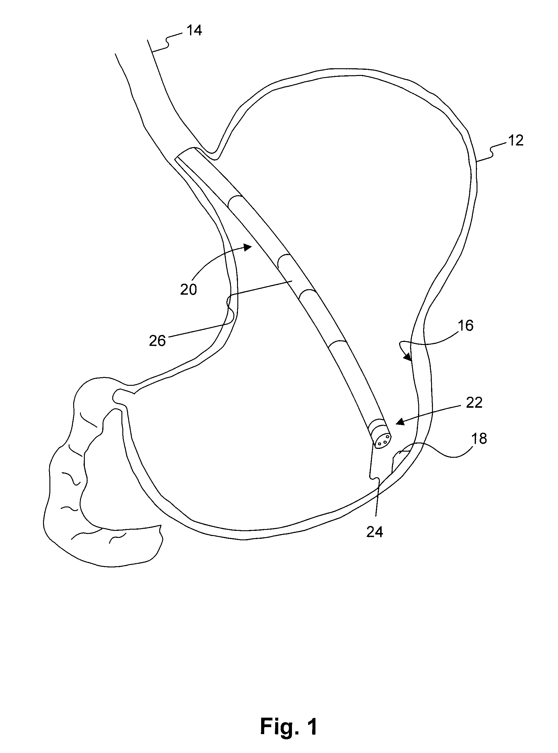 Ultrasound endoscopic system