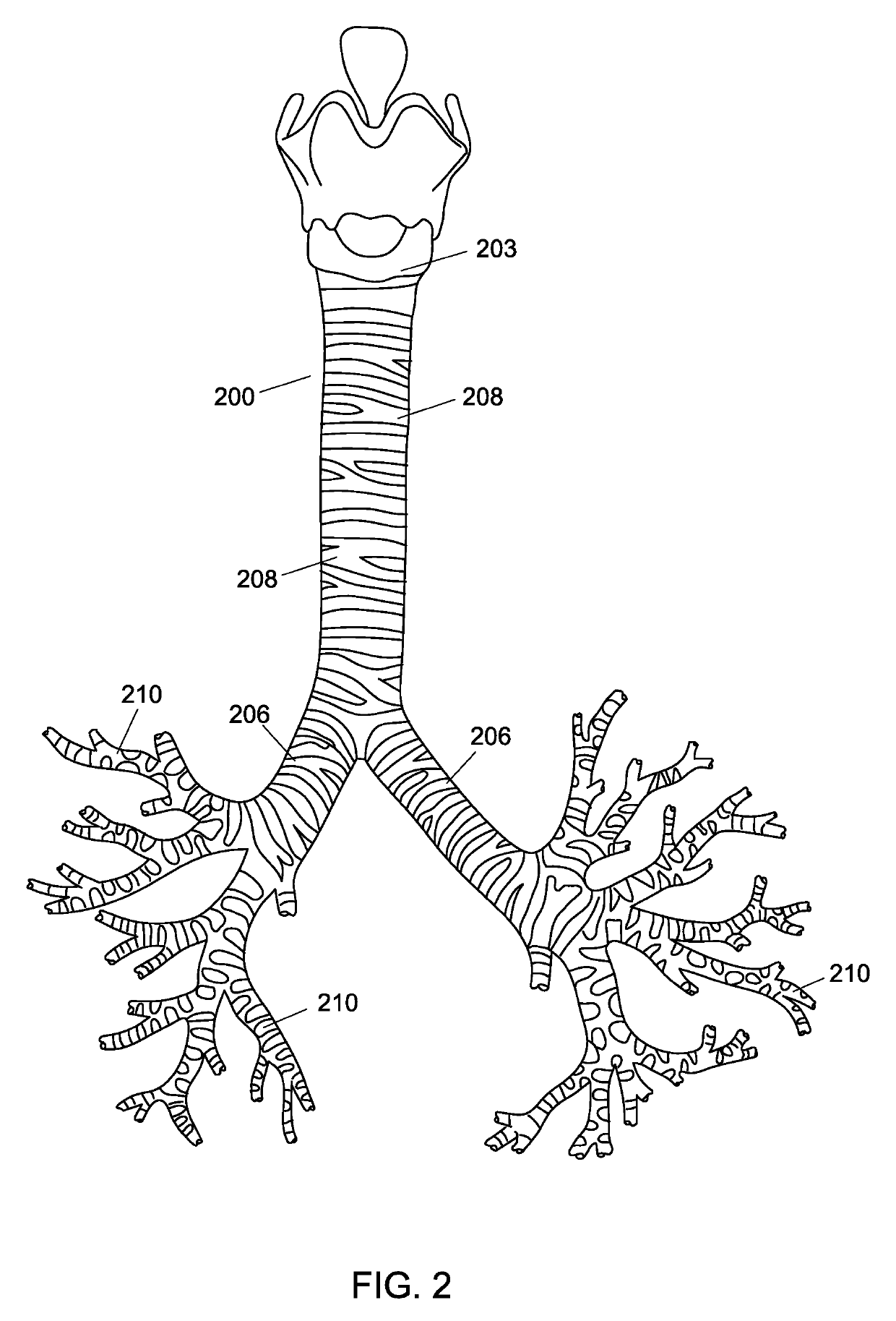 System and method for fabricating custom medical implant devices