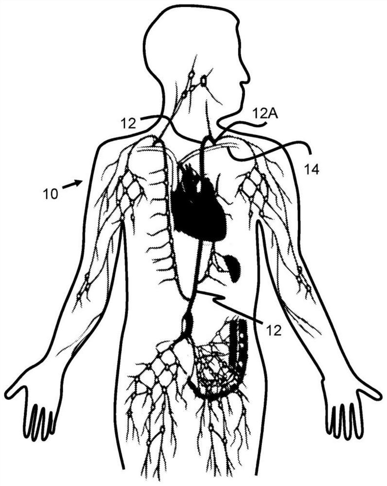 System and method for treatment via bodily drainage or injection