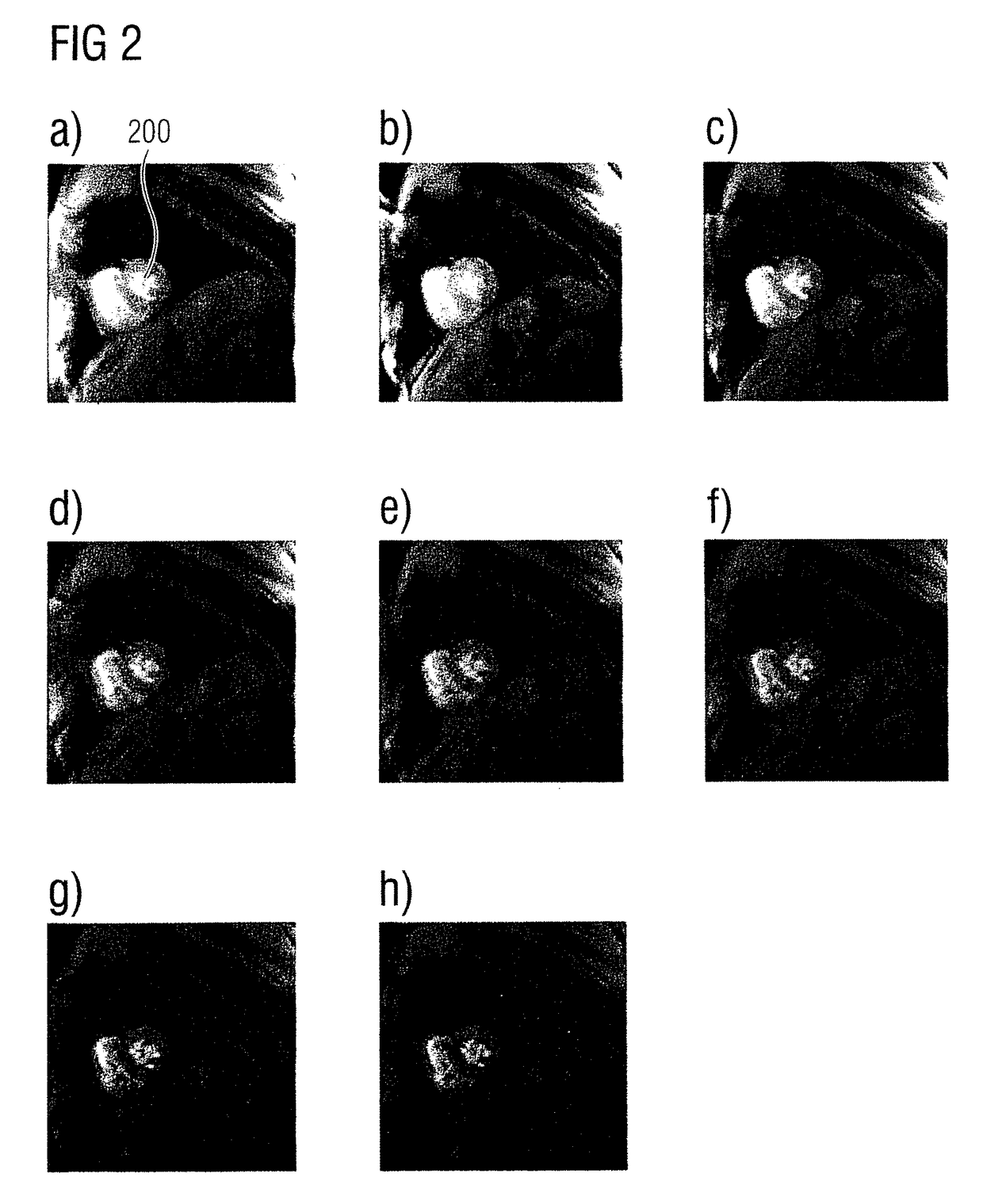 Method and apparatus to determine a magnetic resonance relaxation time in the heart muscle in a magnetic resonance examination