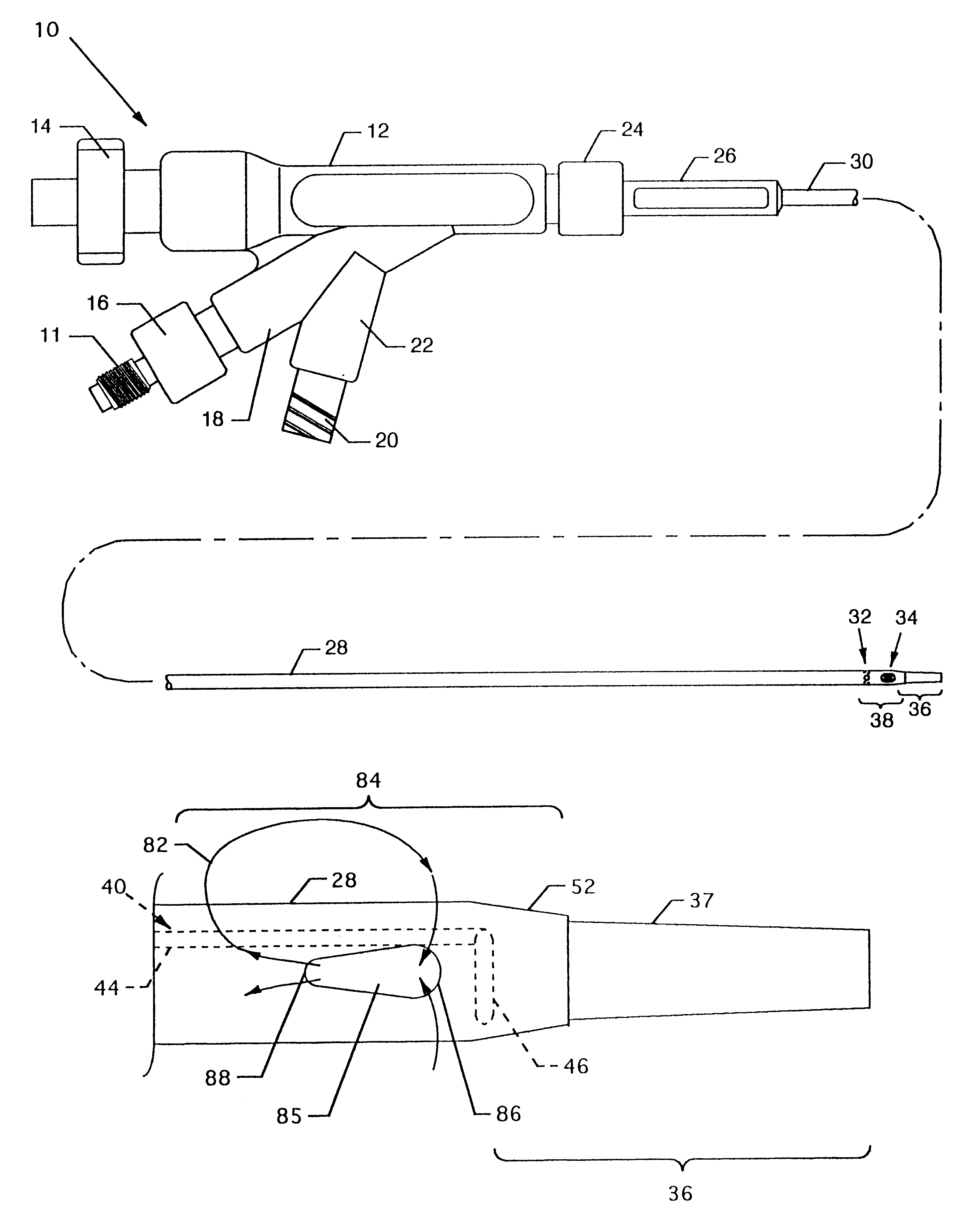 Thrombectomy catheter and system