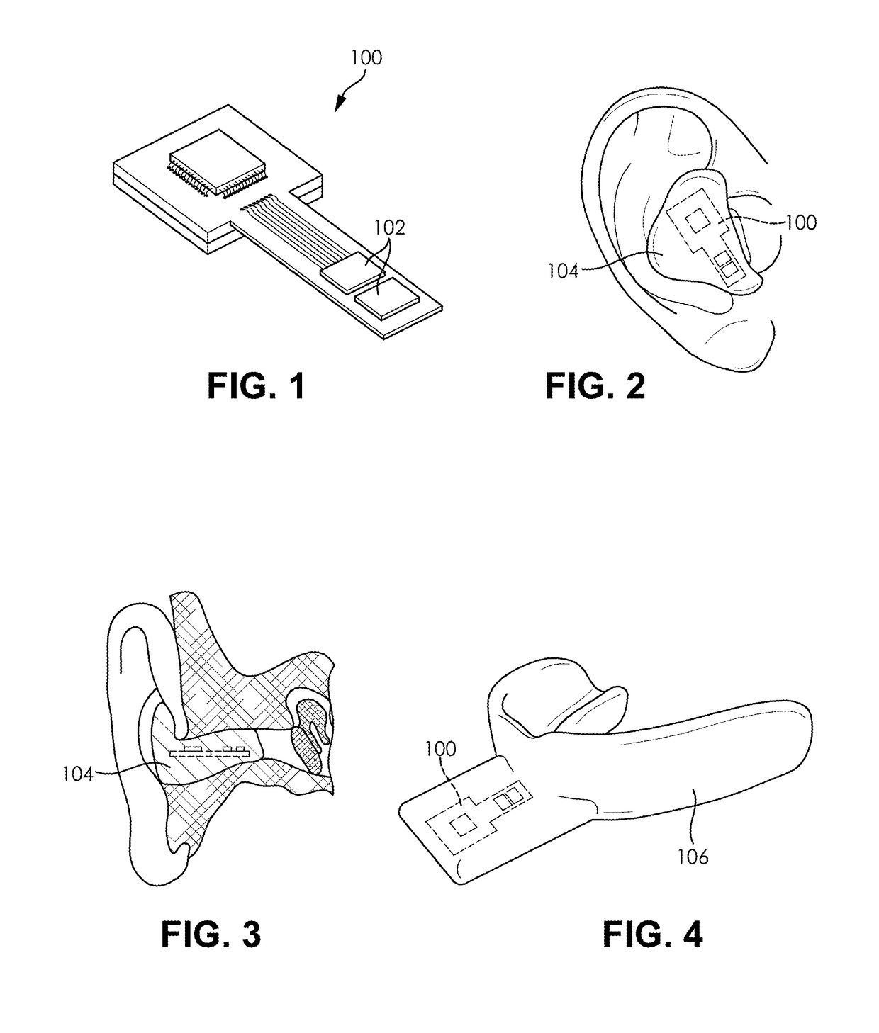 System and method for head acceleration measurement in helmeted activities