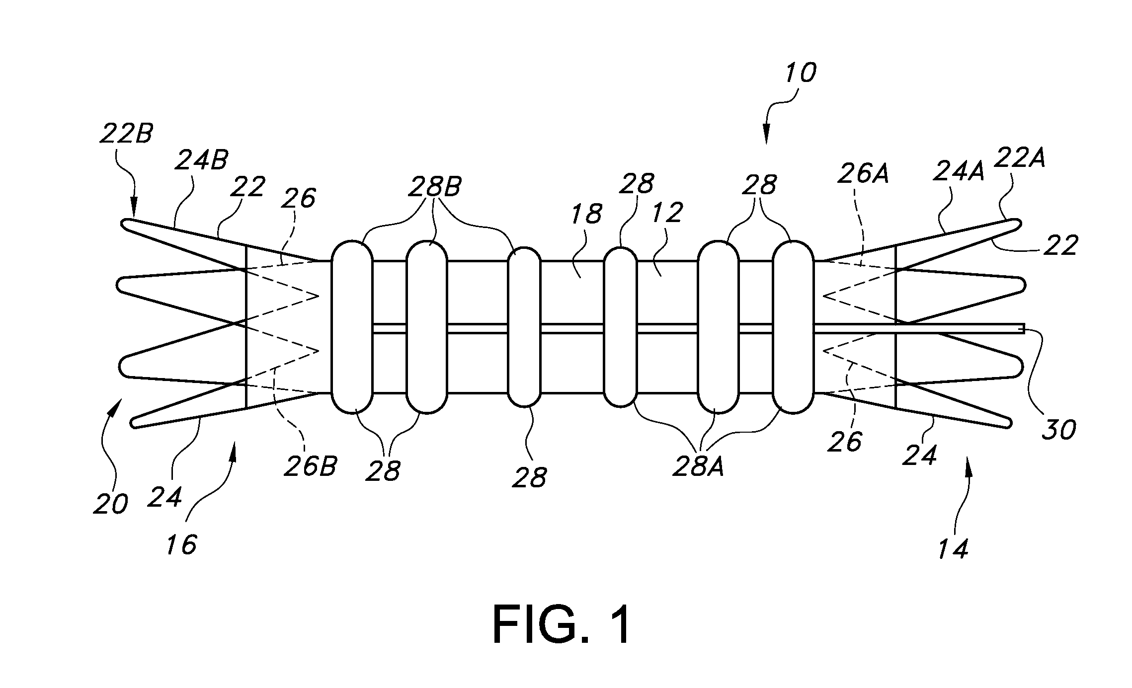 Endovascular graft for aneurysms involving major branch vessels