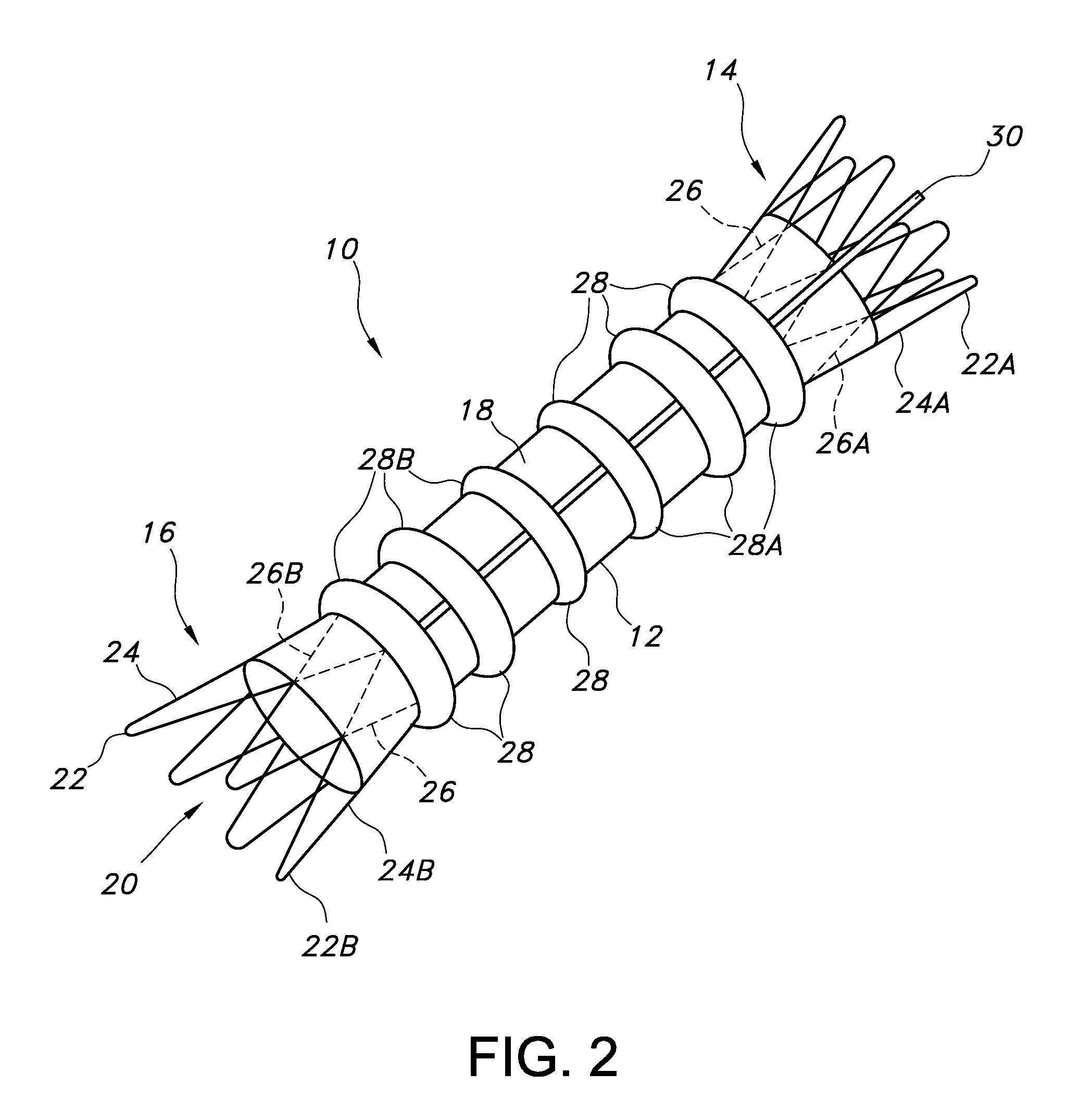 Endovascular graft for aneurysms involving major branch vessels