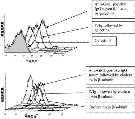 Application of intravenous immunoglobulins (IVIg) in inhibiting cholera toxin and galectin from being combined into ganglioside GM1