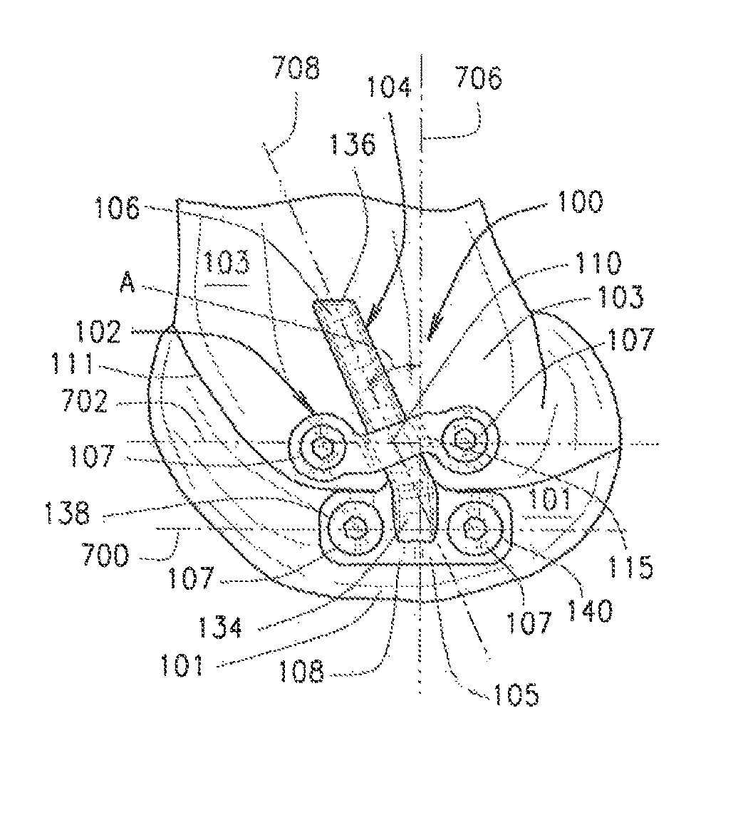 Orthopedic apparatus for correcting rotational bone deformities and method for using the orthopedic apparatus