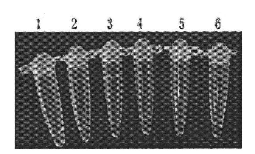 LAMP detection method for babesia bovis