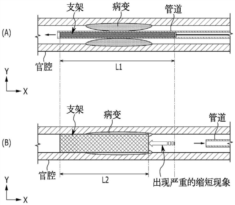 Stent and method for manufacturing same