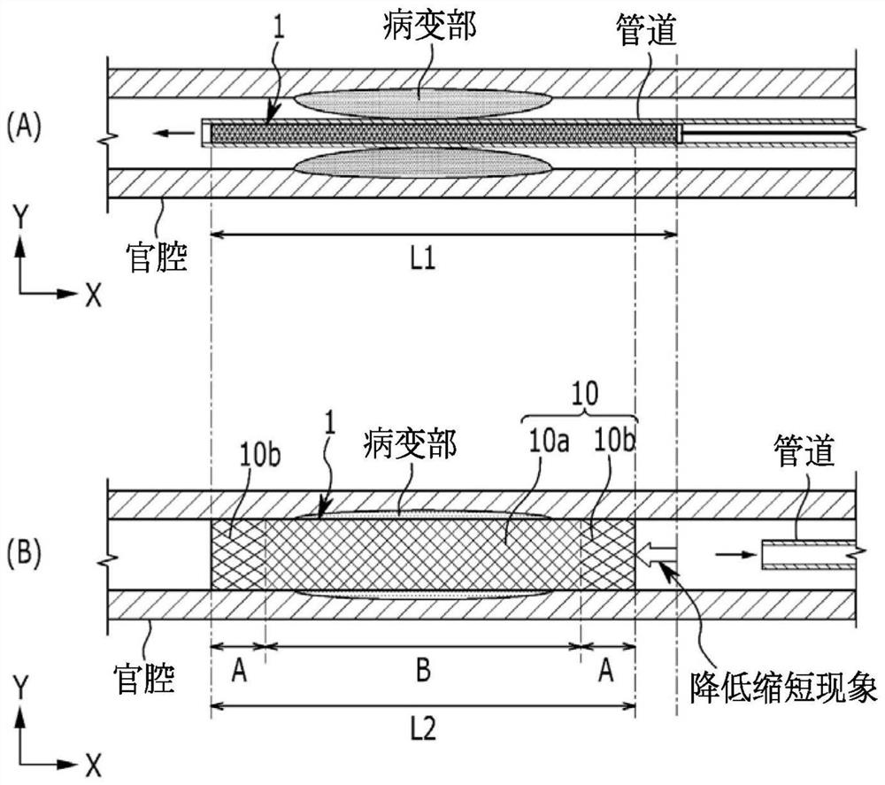 Stent and method for manufacturing same