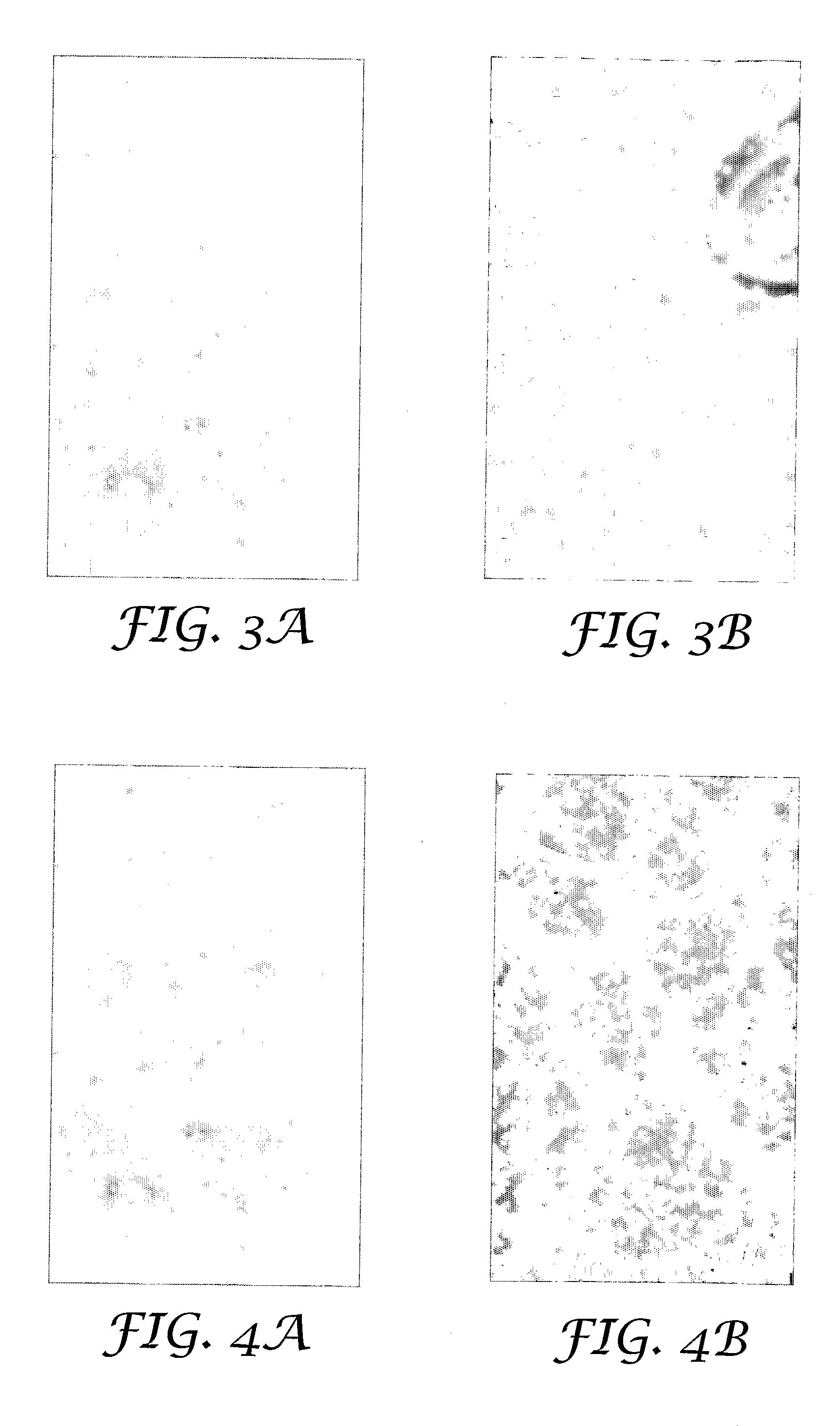 Microneedle Arrays and Methods of Preparing Same